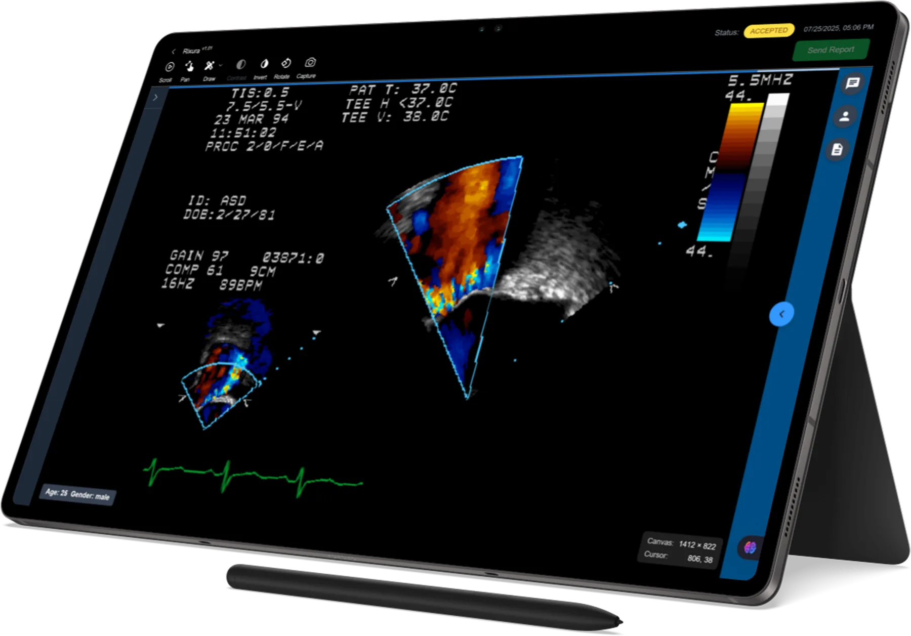 The DICOM viewer